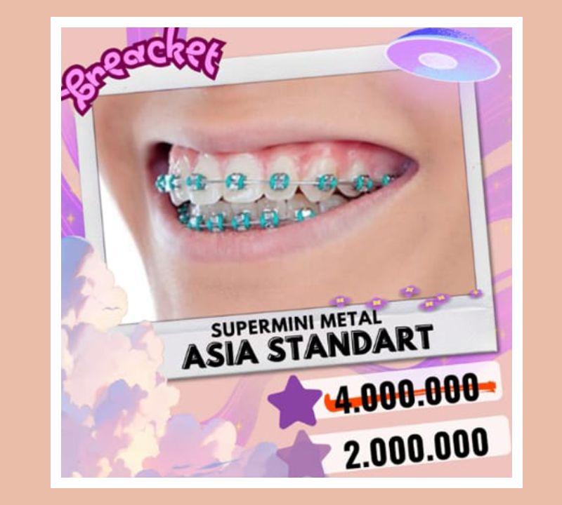 pasang behel gigi asia