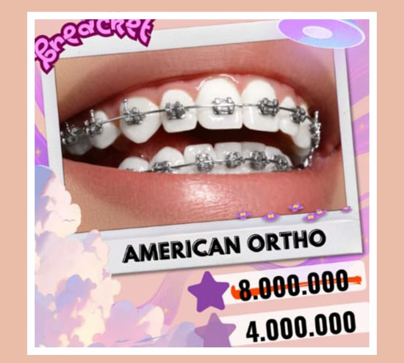 pasang behel gigi american