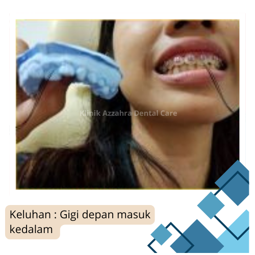 azzahra keluhan gigi masuk dalam