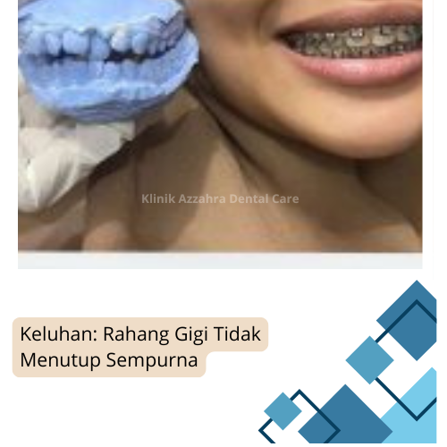 azzahra bentuk rahang tidak simetris